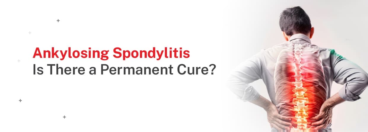 Ankylosing Spondylitis: Is There a Permanent Cure?