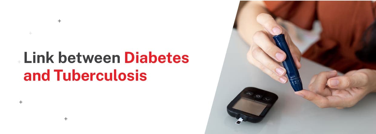 Link between diabetes and tuberculosis