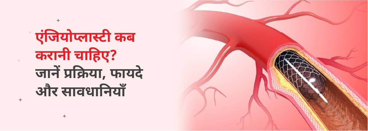 एंजियोप्लास्टी कब करानी चाहिए? जानें प्रक्रिया, फायदे और सावधानियां