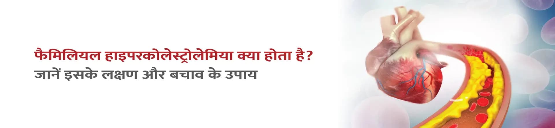 फैमिलियल हाइपरकोलेस्ट्रोलेमिया क्या होता है? जानें इसके लक्षण और बचाव के उपाय