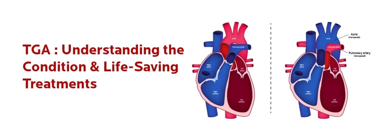 TGA : Understanding the Condition & Life-Saving Treatments