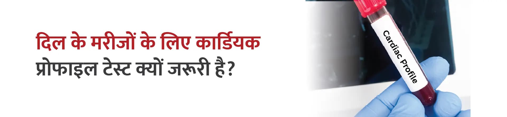 दिल के मरीजों के लिए कार्डियक प्रोफाइल टेस्ट क्यों जरूरी है?