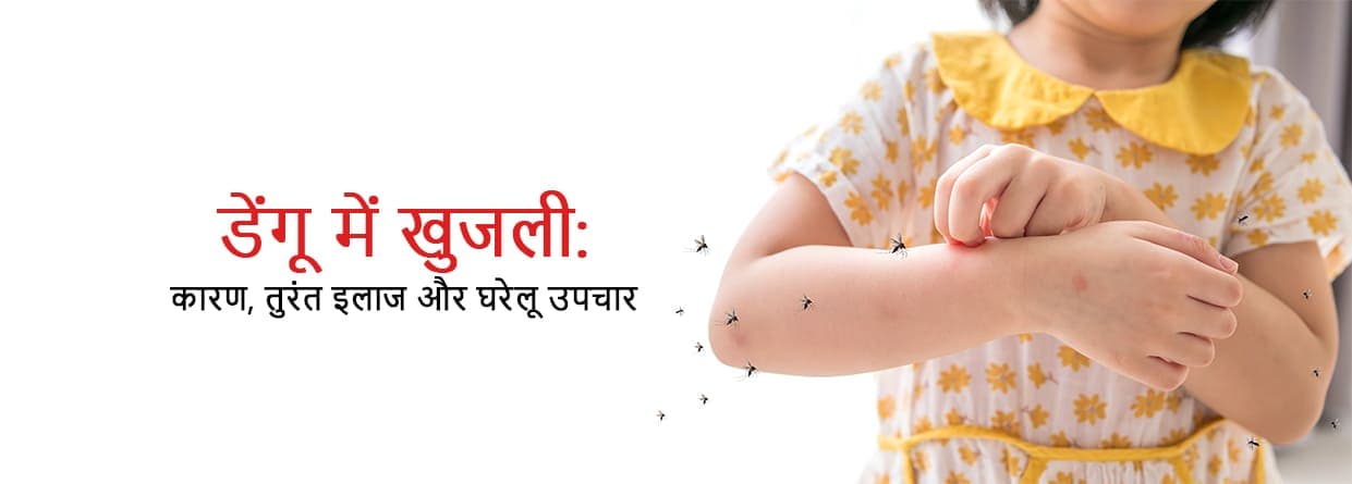 डेंगू में खुजली: कारण, तुरंत इलाज और घरेलू उपचार