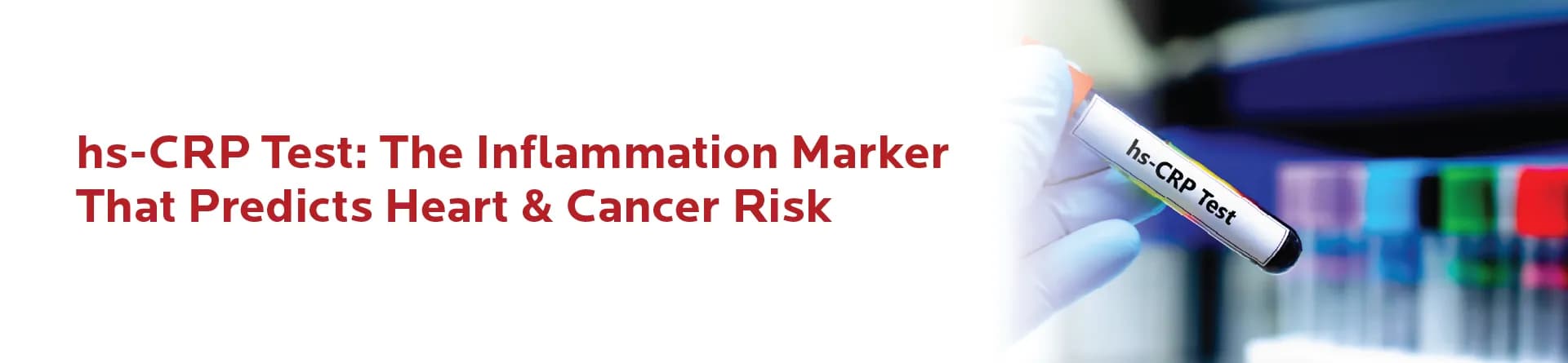 hs-CRP Test: The Inflammation Marker That Predicts Heart & Cancer Risk
