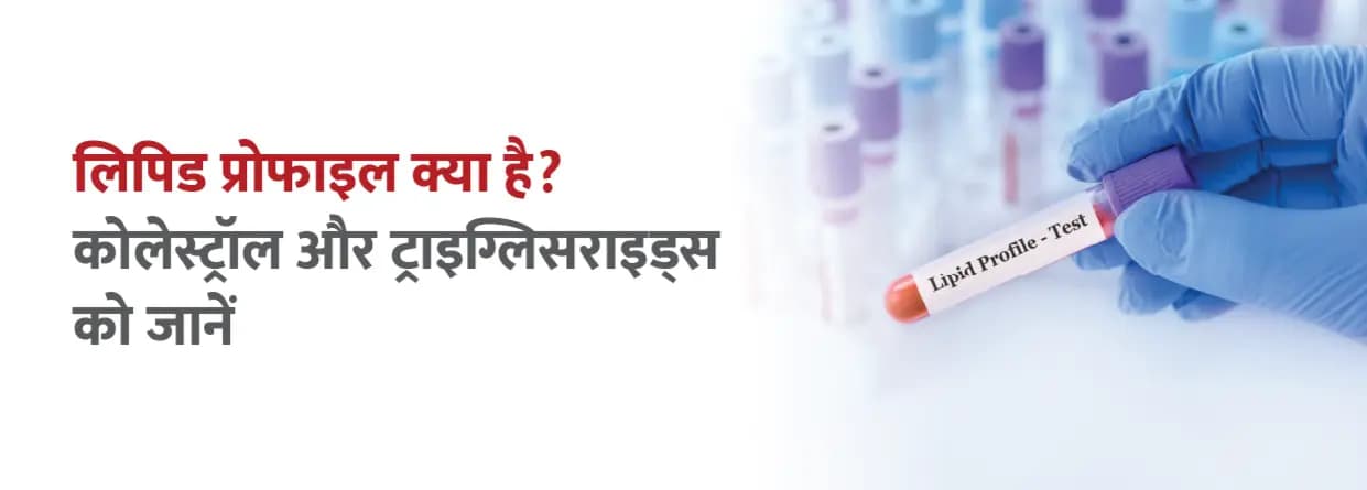 लिपिड प्रोफाइल क्या है? कोलेस्ट्रॉल और ट्राइग्लिसराइड्स को जानें
