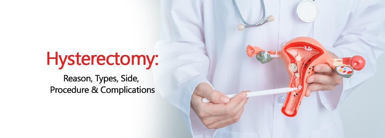 Hysterectomy: Reason, Types, Side, Procedure & Complications