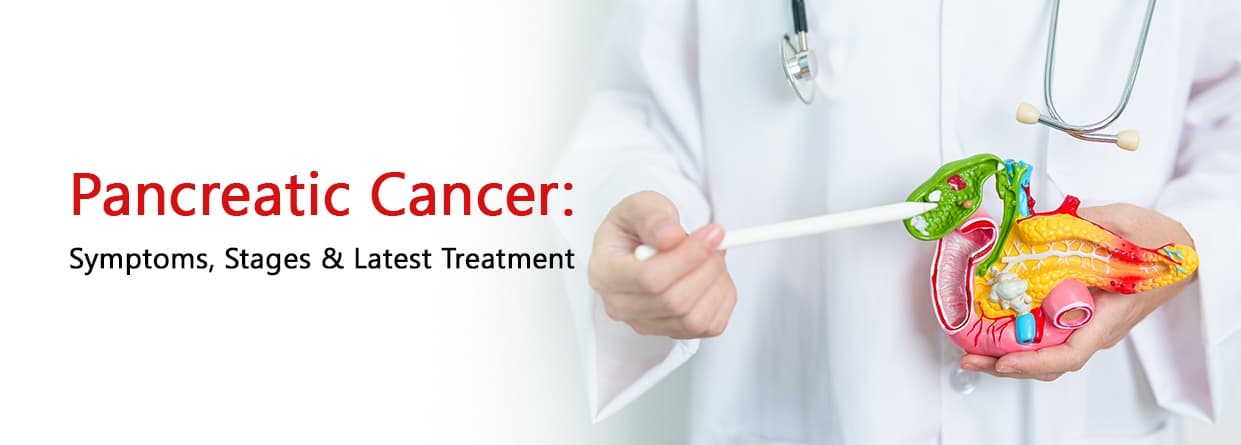 Pancreatic Cancer: Symptoms, Stages & Latest Treatment