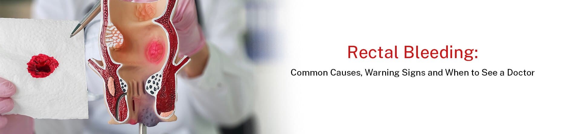 Rectal Bleeding: Common Causes, Warning Signs and When to See a Doctor