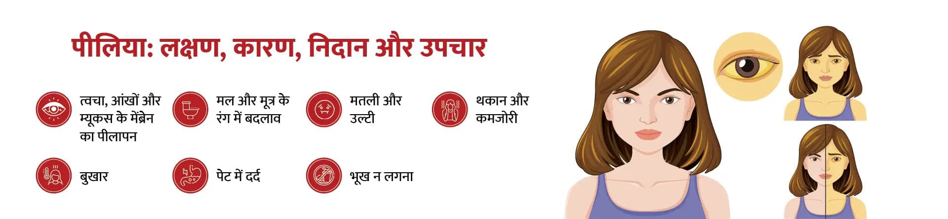 पीलिया: लक्षण, कारण, निदान और उपचार