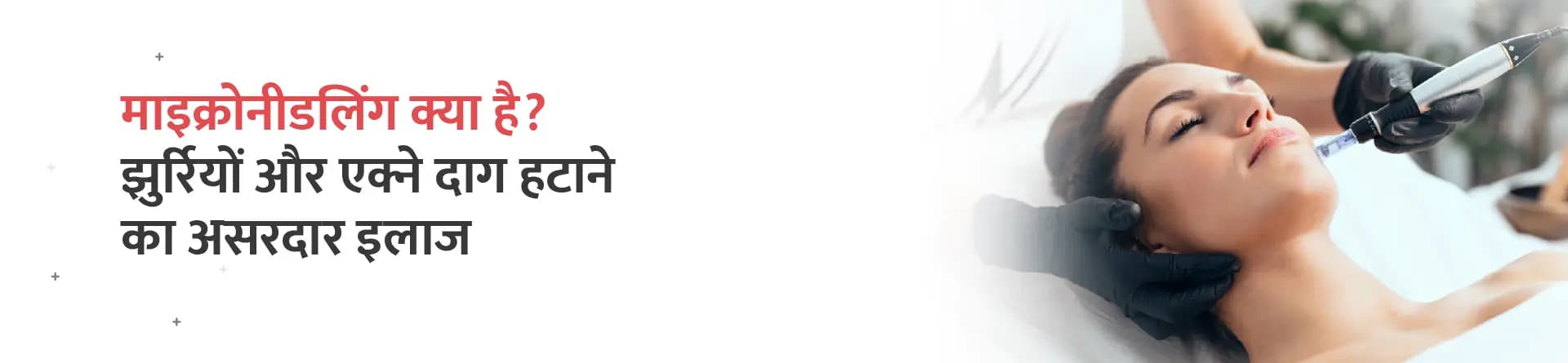 माइक्रोनीडलिंग क्या है? झुर्रियों और एक्ने दाग हटाने का असरदार इलाज