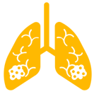 Lung Cancer
