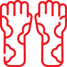 Eczema