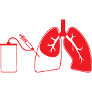 Thoracentesis
