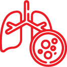 Lung Cancer