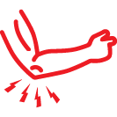 Tendinitis