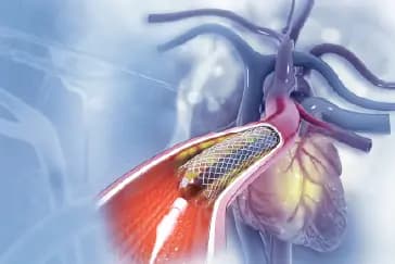 How safe are cardiac catheterization procedures for children?