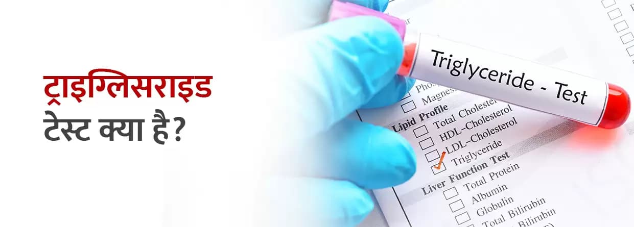 ट्राइग्लिसराइड टेस्ट क्या है?