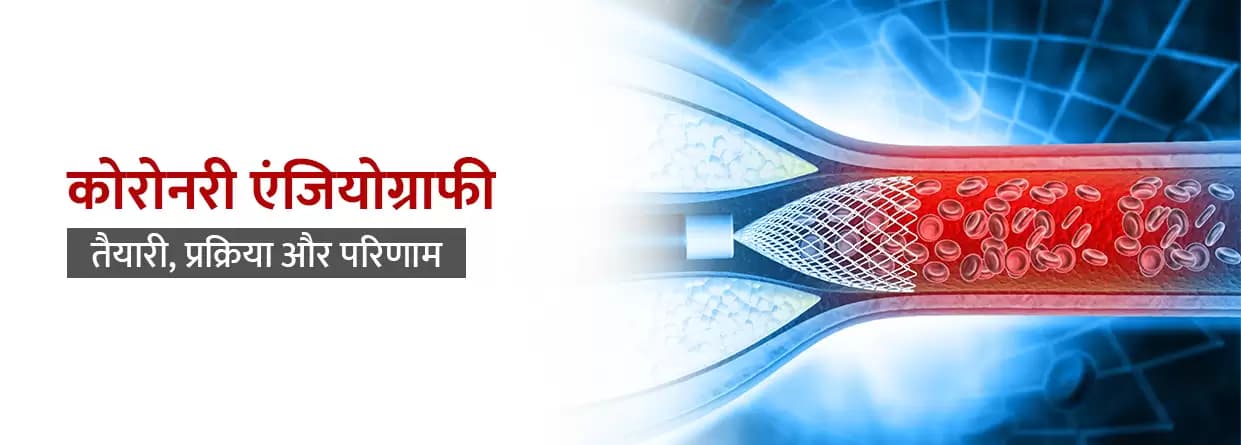 कोरोनरी एंजियोग्राफी: तैयारी, प्रक्रिया और परिणाम