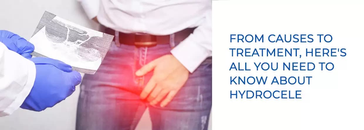 From causes to treatment, heres all you need to know about hydrocele