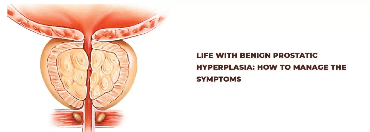 Life with Benign Prostatic Hyperplasia: How to manage the symptoms
