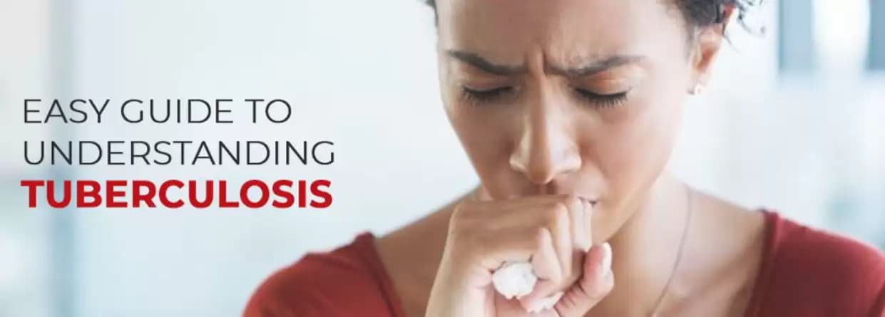 Easy guide to understanding tuberculosis
