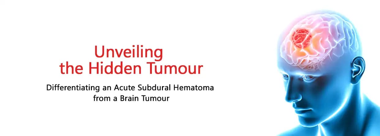Unveiling the Hidden Tumour - Differentiating an Acute Subdural Hematoma from a Brain Tumour