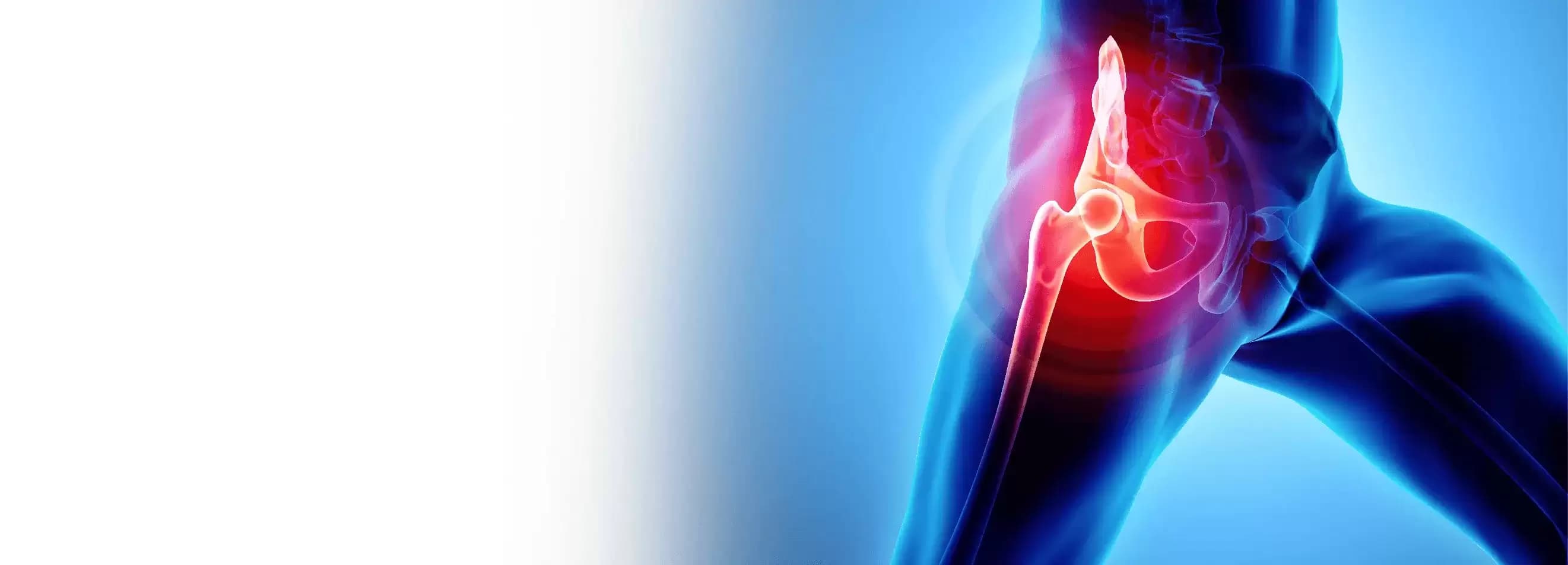 Hip Replacement Surgery