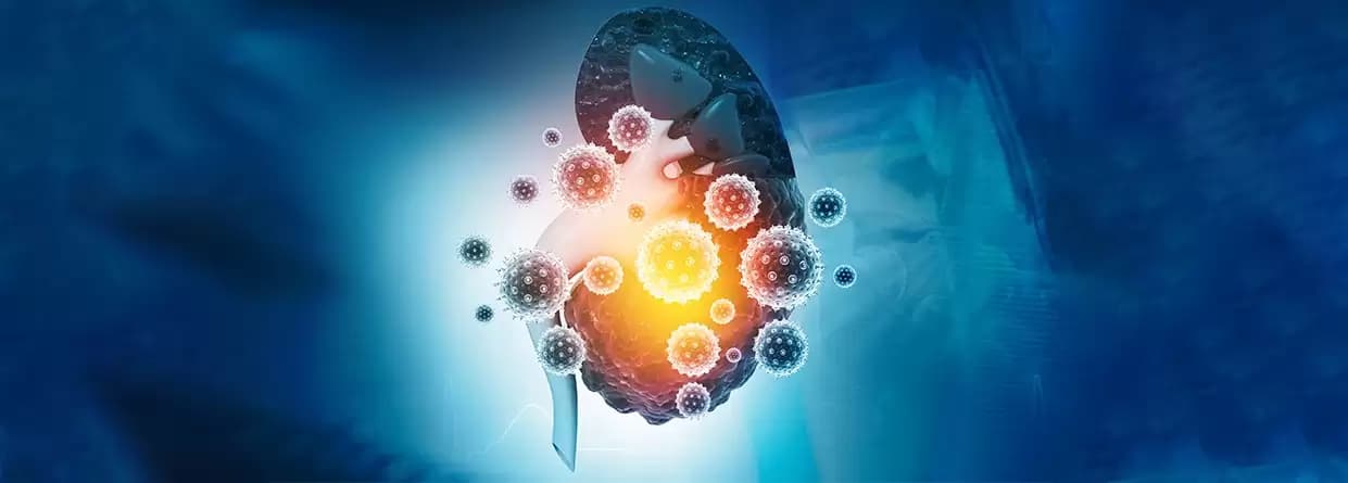 Everything You Need to Know About Polycystic Kidney Disease