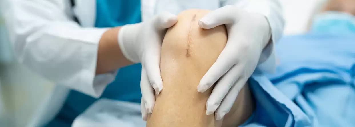 Who Requires a Knee Replacement Surgery?