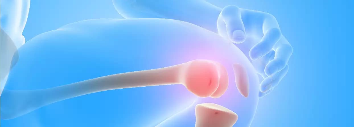 Potential Candidates of Knee Replacement Surgery and Its Various Types