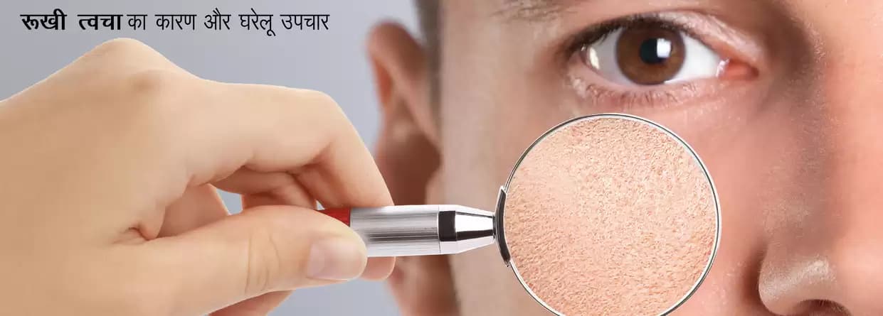रूखी त्वचा का कारण और घरेलू उपचार