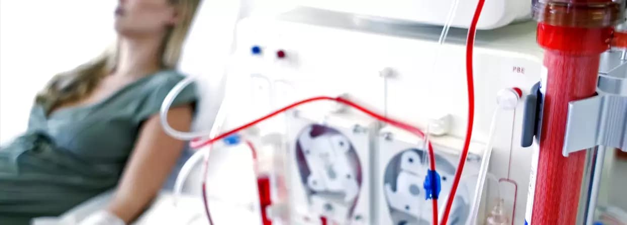 SUSTAINED LOW-EFFICIENCY DAILY DIALYSIS (SLEDD)