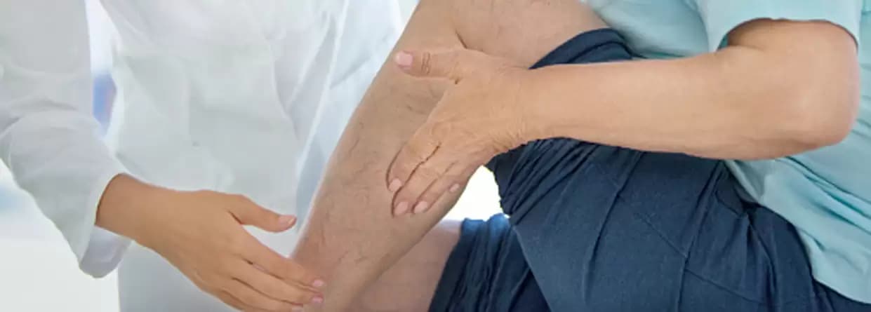 Varicose Vein Surgery