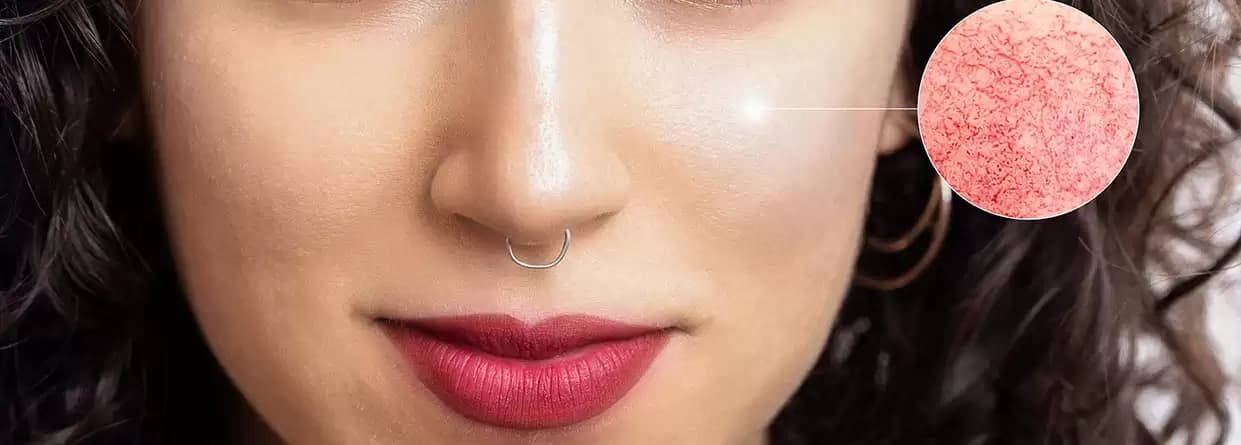 Know The Most Common Diseases Of Dermatology