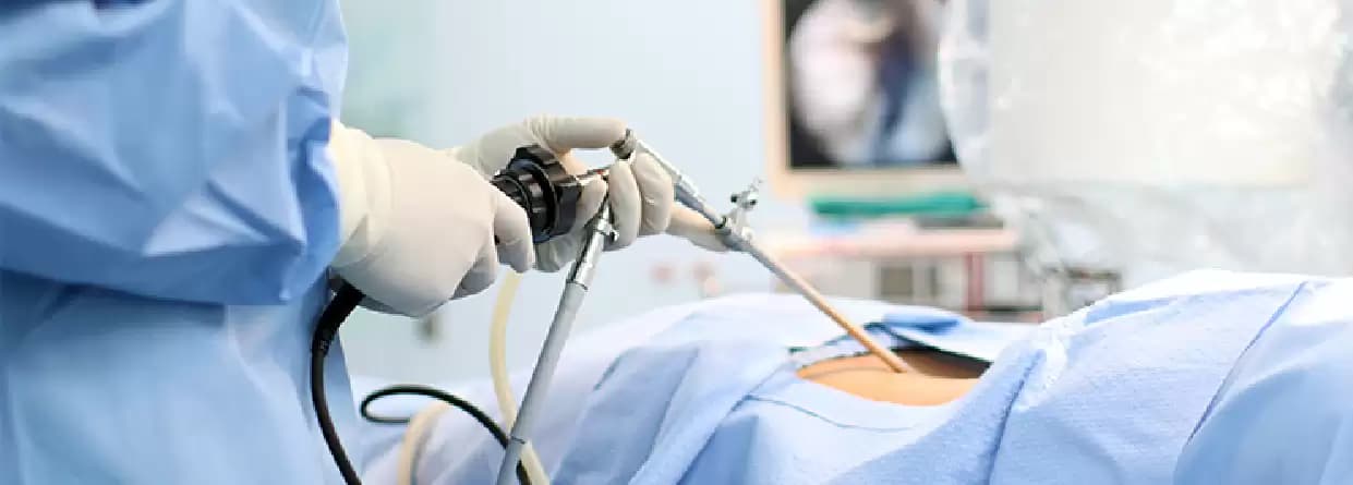 Laparoscopic Surgery for Gastrointestinal Disorders
