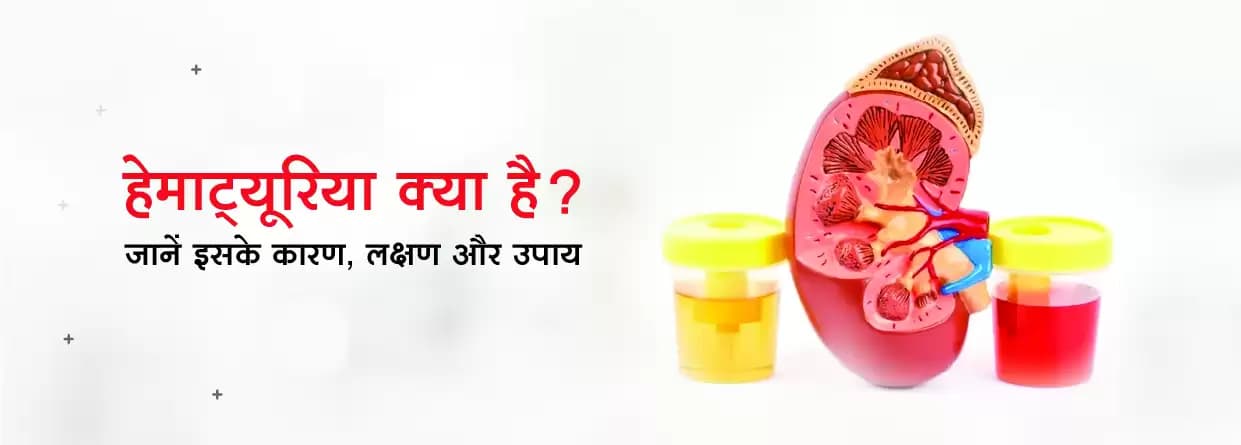 हेमाट्यूरिया क्या है? जानें इसके कारण, लक्षण और उपाय