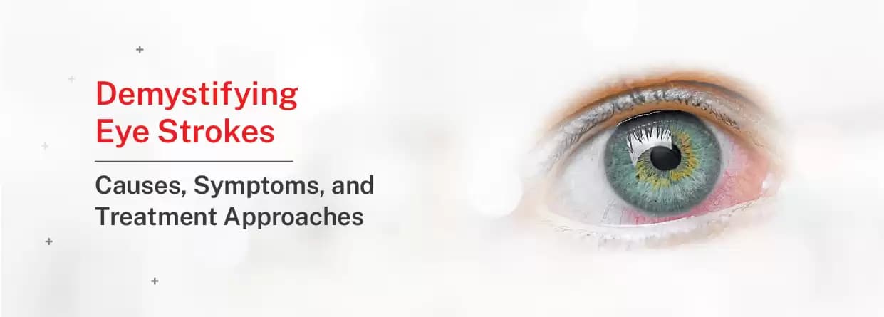 Demystifying Eye Strokes: Causes, Symptoms, and Treatment Approaches