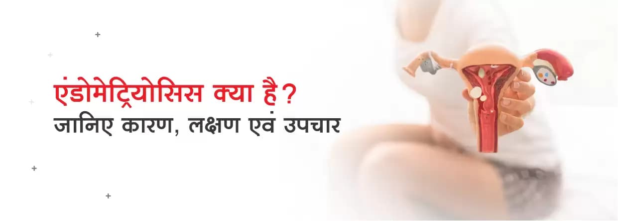 एंडोमेट्रियोसिस क्या है? जानिए कारण, लक्षण एवं उपचार