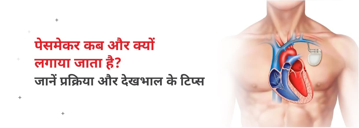 पेसमेकर कब और क्यों लगाया जाता है? प्रक्रिया और देखभाल के टिप्स