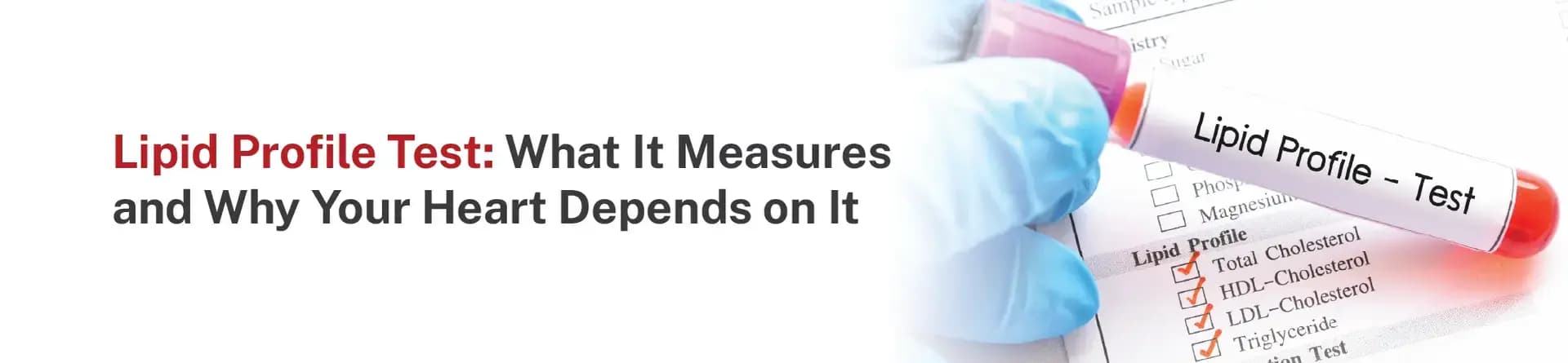 Lipid Profile Test: What It Measures and Why Your Heart Depends on It