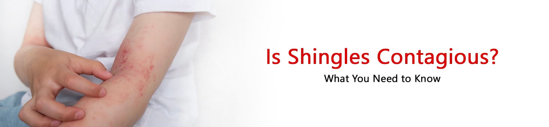 Is Shingles Contagious? What You Need to Know