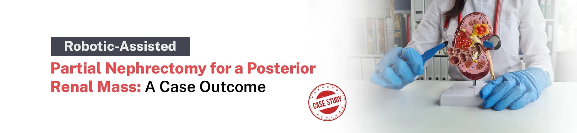 Robotic-Assisted Partial Nephrectomy for a Posterior Renal Mass: A Case Outcome