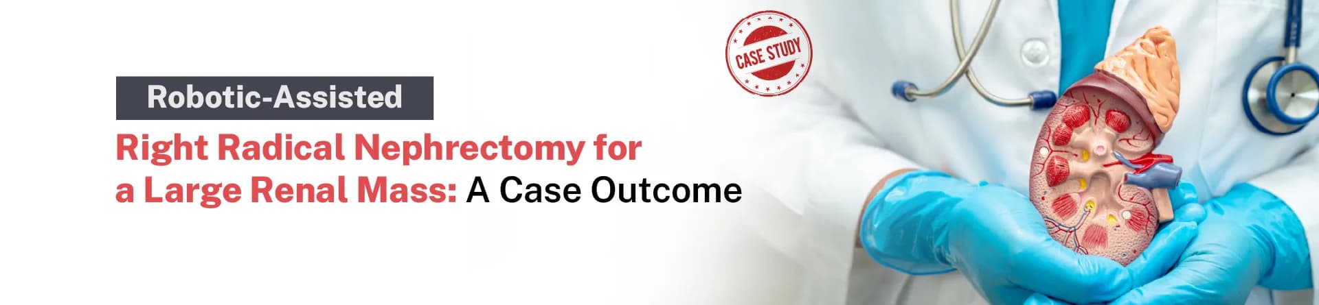 Robotic-Assisted Right Radical Nephrectomy for a Large Renal Mass: A Case Outcome