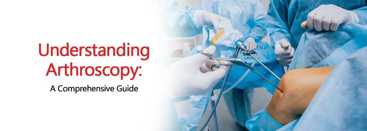 Understanding Arthroscopy: A Comprehensive Guide