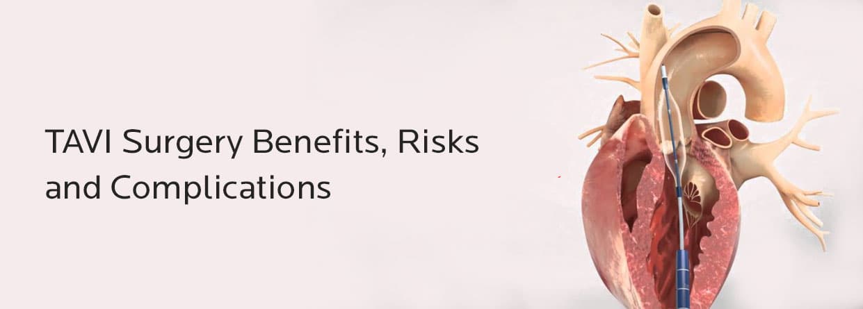 TAVI Surgery Benefits, Risks and Complications