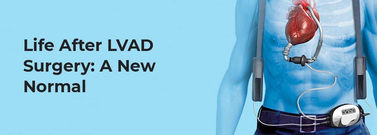 Life After LVAD Surgery: A New Normal