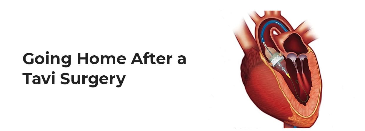 Going Home After a TAVI Surgery