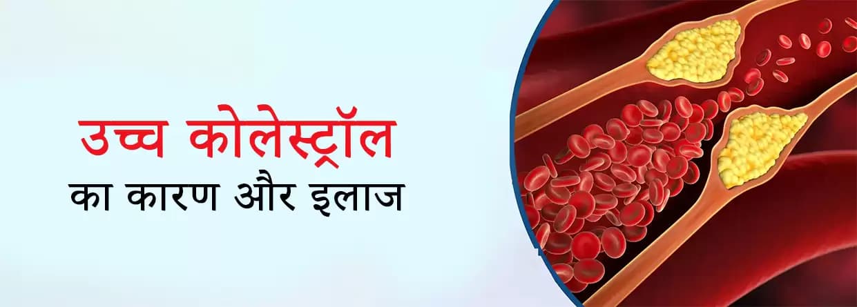 हाई कोलेस्ट्रॉल कैसे कम करें? अनुभवी डॉक्टरों की गाइड