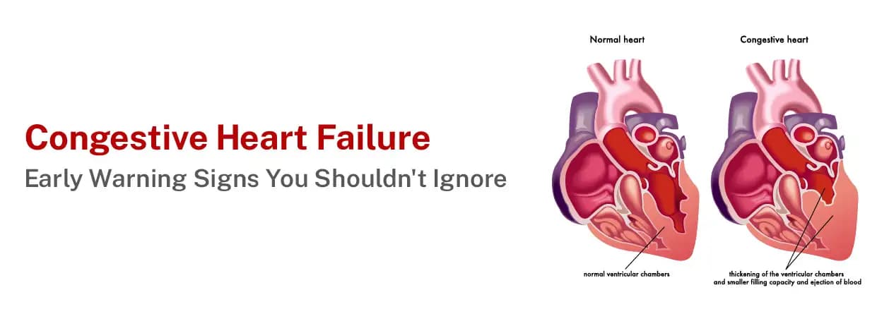 Congestive Heart Failure: Early Warning Signs You Shouldn't Ignore