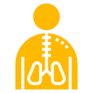 Cystic Fibrosis